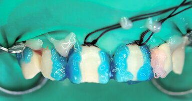 Multidisciplinární přístup s Er,Cr:YSGG laserem – Estetický management tvrdých a měkkých tkání