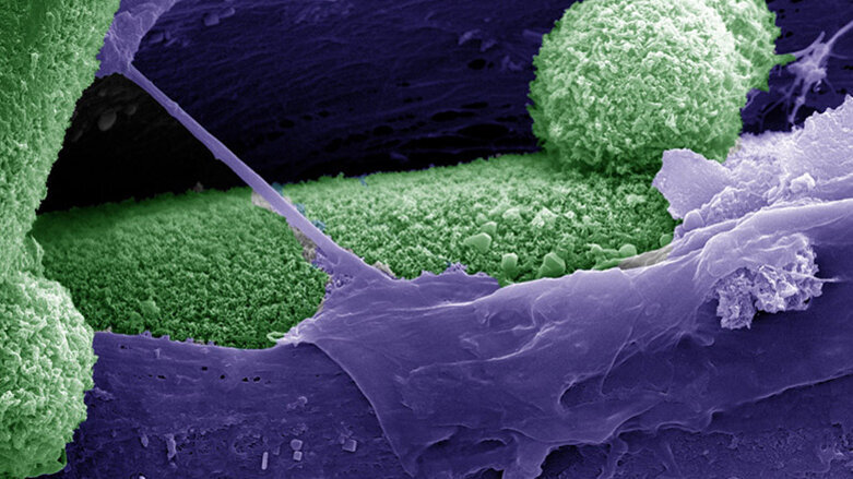 Hauptschalter für die Regeneration von Knochengewebe aufgedeckt