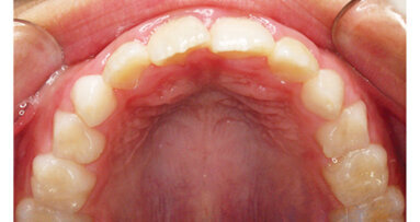 Mystery and controversy are directly proportional