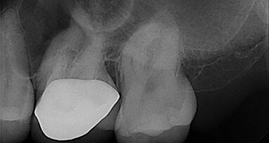 EdgeFile X7: Beastly bifurcation