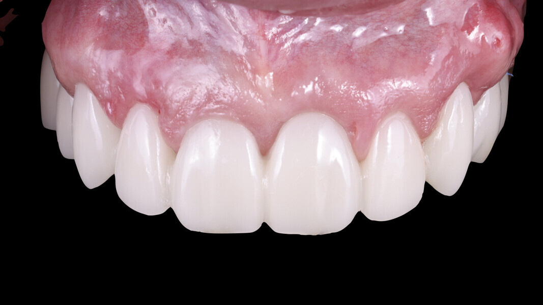 Fig. 23: Healing after two weeks.