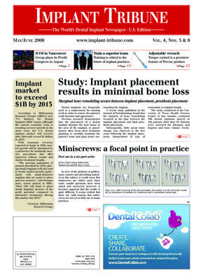 Implant Tribune U.S.