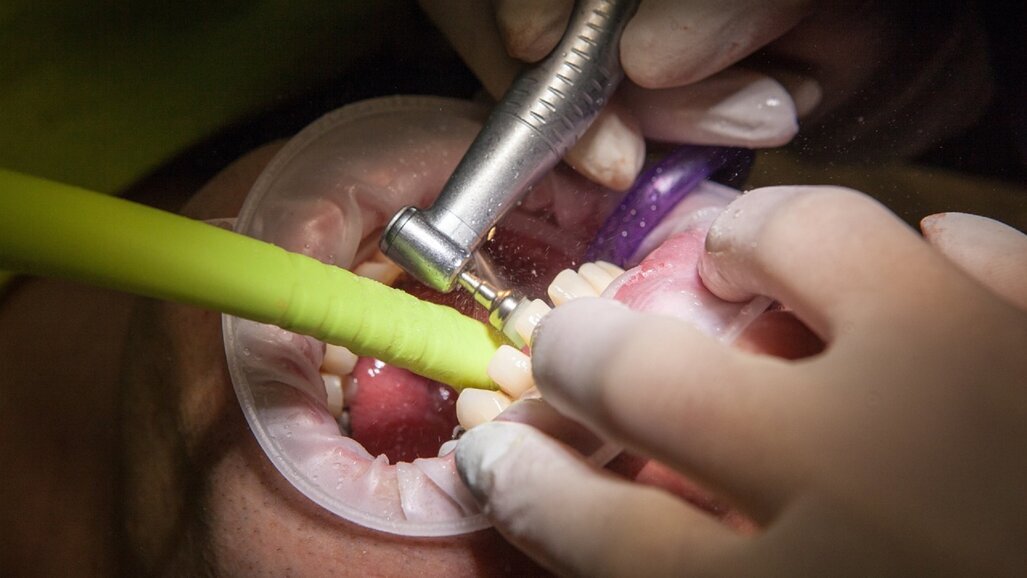 Najwyższa Izba Kontroli o darmowym leczeniu zębów