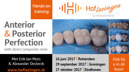 Hands-on training: werken met composiet in front en zijdelingse delen