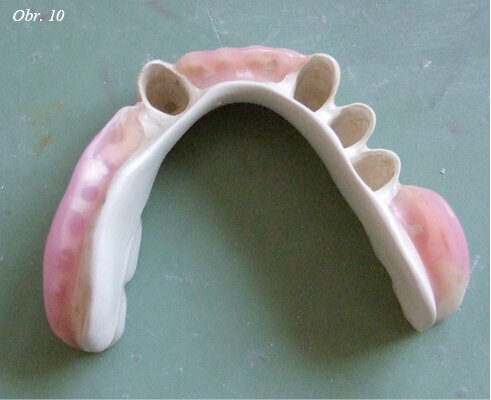 Obr. 10