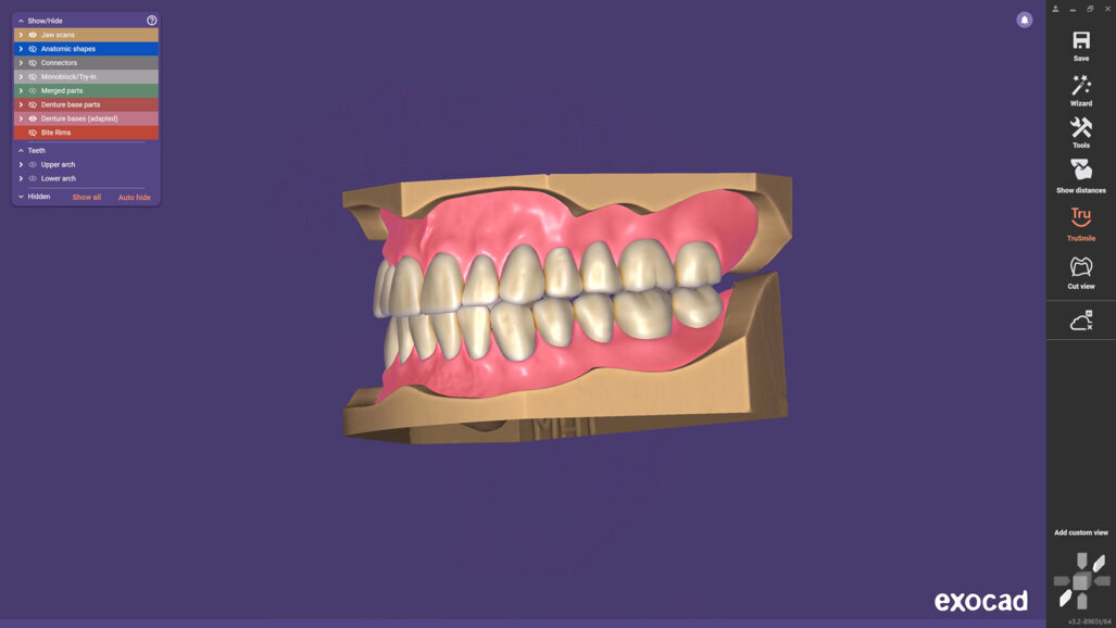 Exocad launches Inspira Denture Tooth Library