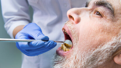 Schlechte Mundhygiene beschleunigt schwere COVID-19 Verläufe Schlechte Mundhygiene beschleunigt schwere COVID-19 Verläufe