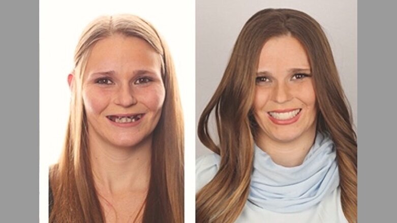 Caso Clínico: Una sonrisa para Andrea