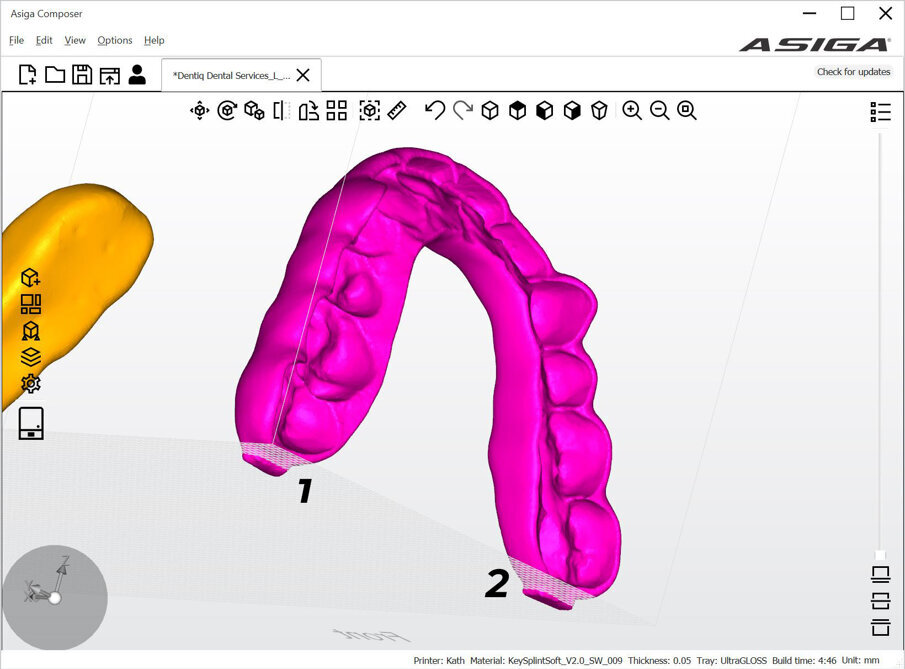 Obr. 7: Detailní pohled na uchycení dlahy k tiskové platformě (Asiga Composer).