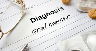 Grazie alla visualizzazione a fluorescenza la recidiva del cancro orale potrebbe diminuire