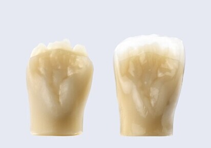 Ceramill Mindforms Cutback Extension