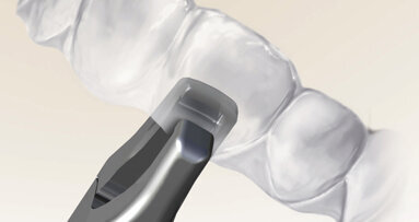 Kreativní doplňky ke zvýšení prediktability léčby fóliovými aparáty