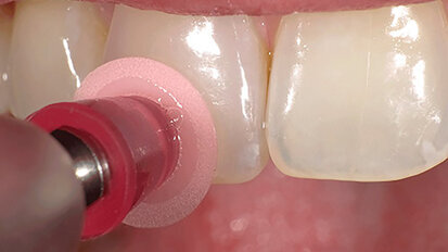 Super-Snap, eficiencia para el pulido y acabado Super-Snap, eficiencia para el pulido y acabado