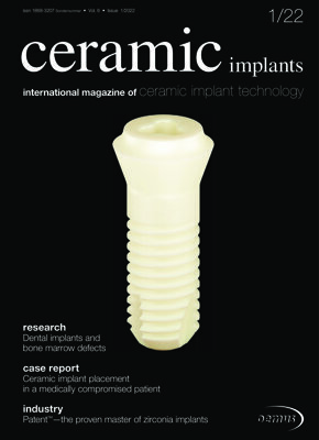 ceramic implants international No. 1, 2022 ceramic implants international No. 1, 2022