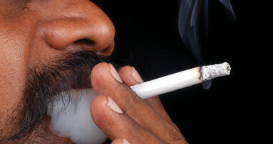 Top 10 causes of tooth discoloration