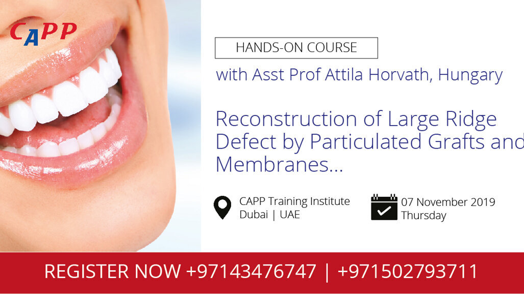 Reconstruction of Large Ridge Defect by Particulated Grafts and Membranes...