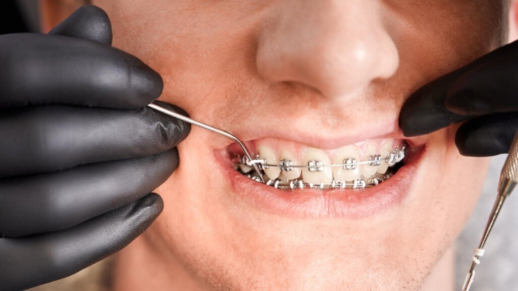 Prawidłowy zgryz to warunek utrzymania równowagi funkcjonalnej całego organizmu