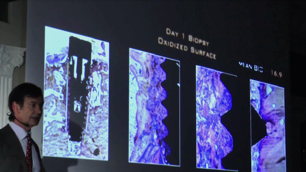„Od osteointegracji do periointegracji” – implanty szorstkie czy maszynowe?