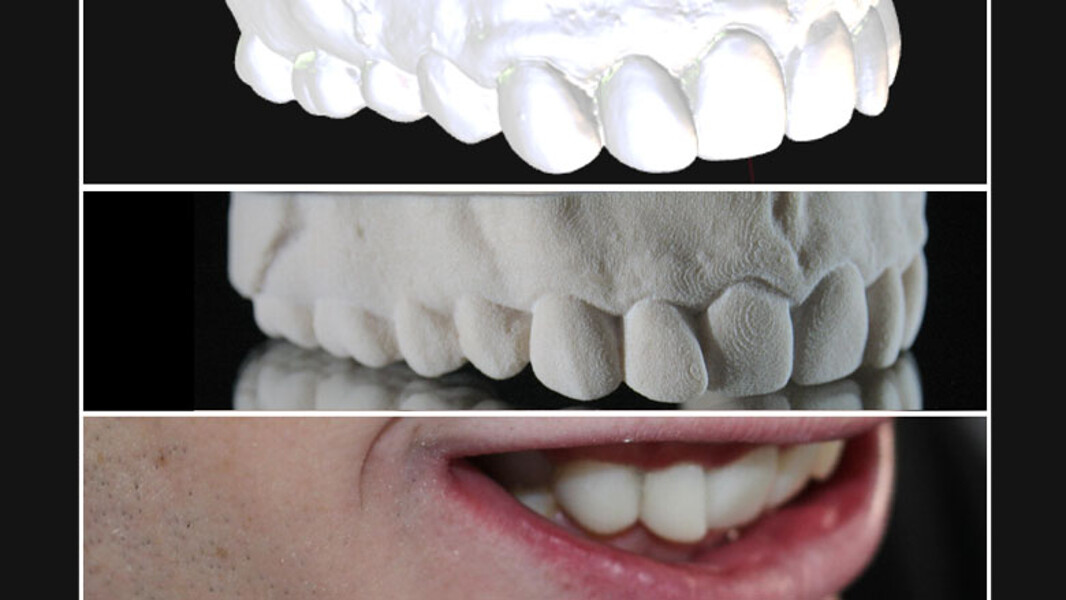 Figura 10. Comparación del wax-up digital, modelo estereolitográfico y caso final.