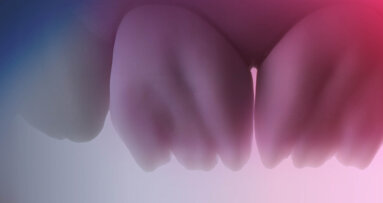 CERABIEN MiLai: Practical chroma map catalogue simplifies anterior restorations