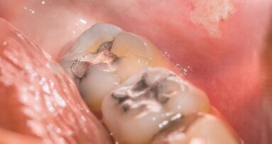 Възход и падение на живака