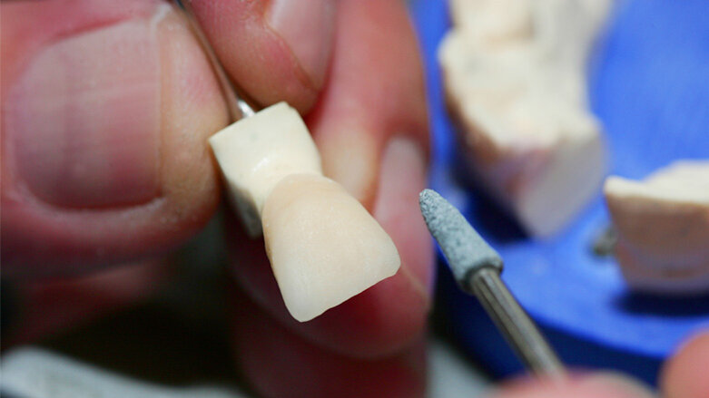 Meisterzwang für Zahntechniker vom Oberverwaltungsgericht bestätigt