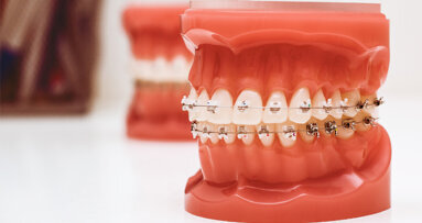 IGES-Gutachten zum Nutzen von KFO-Behandlungen falsch interpretiert