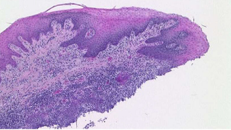 Evaluation of an ex vivo porcine model to  investigate the effect of low abrasive airpolishing