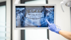 Jedes achte Röntgengerät mit Mängeln – das zeigt der TÜV-Report