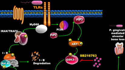Scientist discovers mechanism to reduce inflammation and subsequent bone loss related to gum disease Scientist discovers mechanism to reduce inflammation and subsequent bone loss related to gum disease
