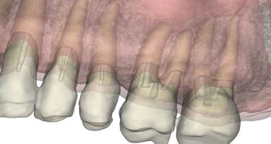 A new paradigm in surgical training