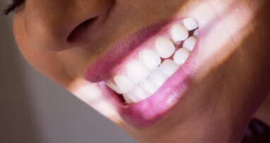 Paski wybielające bez nadtlenków coraz popularniejsze wśród pacjentów