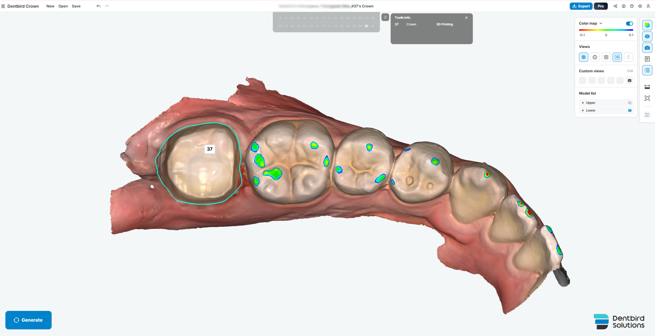 Fig. 2: Initial margin line detected by AI for tooth #37. 