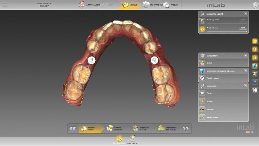 Fig. 10_Il rendering con il software Dentsply Sirona inLab.