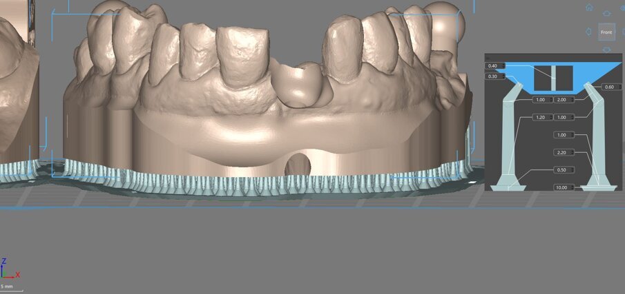 Figg. 10, 11_Esempio di distribuzione dei supporti di stampa.