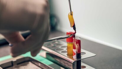 Weltweit erste Leitlinie: Platelet-Rich-Fibrin in der Implantologie