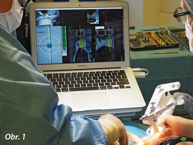 CBCT sken byl pořízen dva týdny  před chirurgickým zákrokem