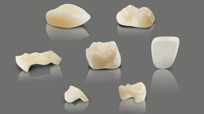 Interview: Fast, affordable and aesthetic 3D-printed dental restorations Interview: Fast, affordable and aesthetic 3D-printed dental restorations