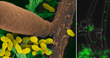 Interaktion verschiedener Pathogene verantwortlich für Kariesbildung