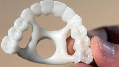 Hybrid Technologies grows business with full-arch palatal Jigs 3D printed on NextDent 5100