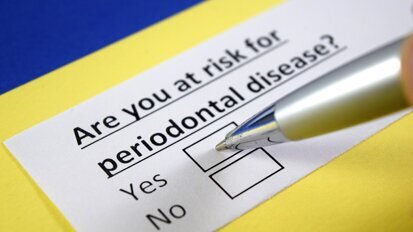 德国研究人员辨认出与牙周疾病具有关联性的DNA