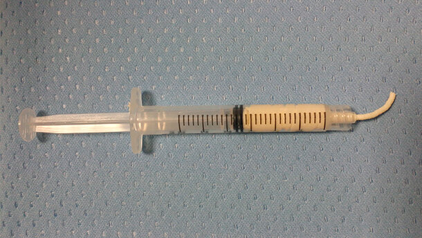 Il DBGRaft-T evoluzione studiata in particolare per l’applicazione in ambito odontostomatologico della pasta d’osso DBGraft prodotta e distribuita dalla BCTM dal 2011