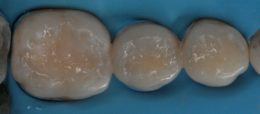 Fig. 27_Restauro effettuato.