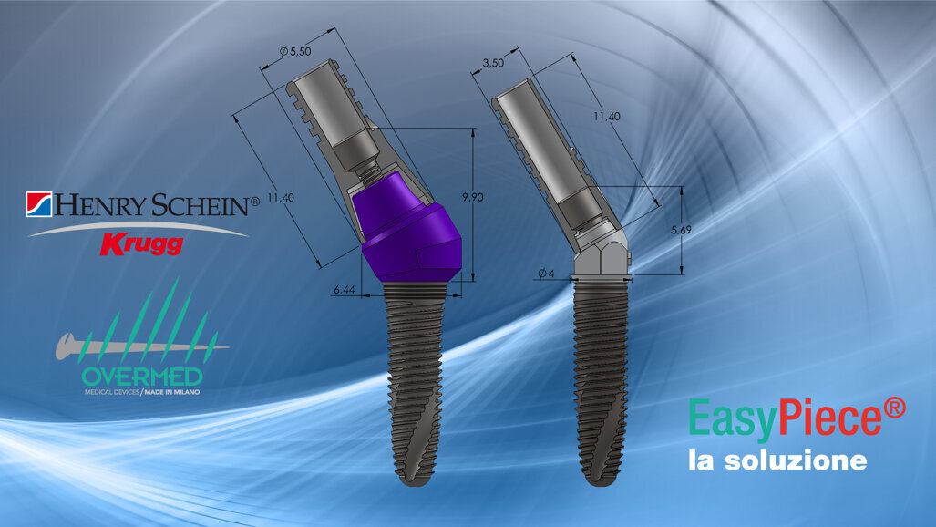 Grandi novità ad Expodental da Overmed e Henry Schein