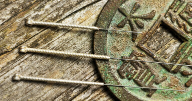 Acupuncture: Probing its way into dentistry—Part II