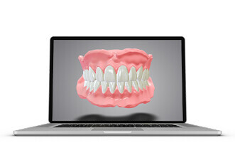 Dental Wings – DWOS Full Dentures