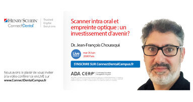 Webinaire : Scanner intra oral et empreinte optique : un investissement d’avenir ?