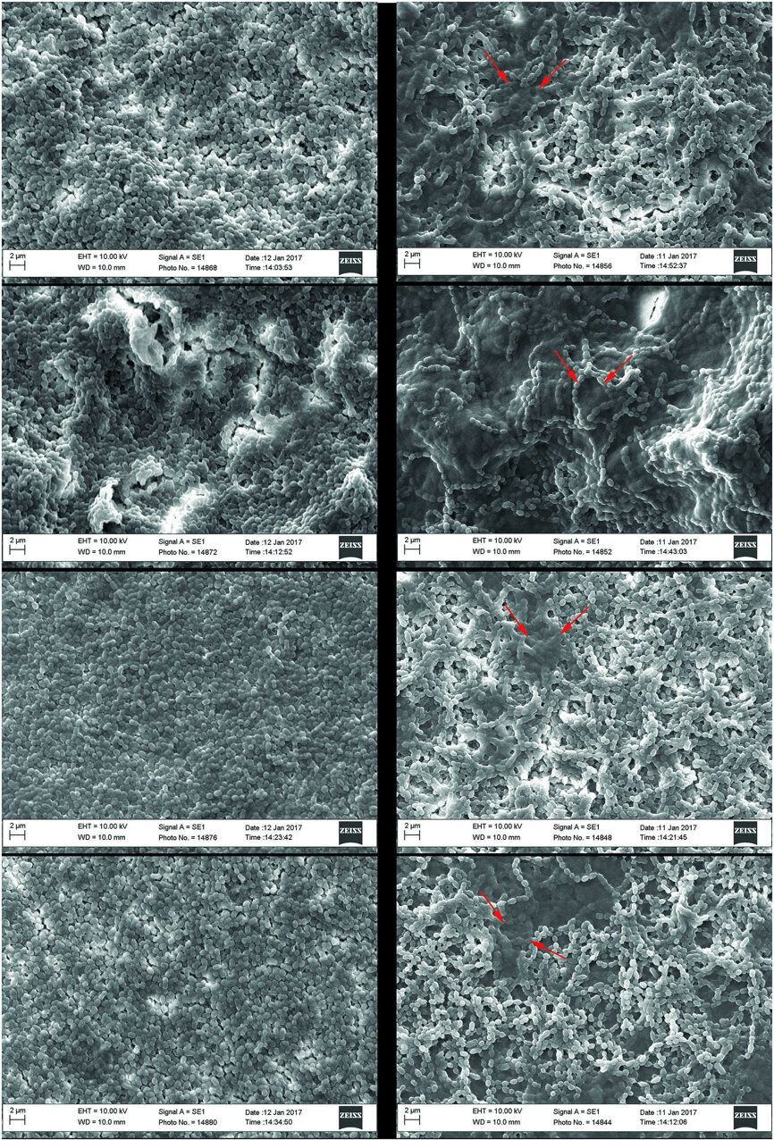 Fig 3 : Micrographies par microscopie électronique a balayage des biofilms formes par Streptococcus sanguinis à 72 heures (gauche) et 120 heures (droite), de haut en bas : polyetherethercetone (PEEK), PEEK sablé, titane pur commercial, et titane-6 aluminum-4 vanadium. Les biofilms sont clairement présents sur toutes les surfaces. Certaines des bactéries présentes sur les images, surtout à 120 heures, sont masquées par une substance ayant l’ aspect d’une matrice (taches foncées) autour des streptocoques. Trait représentant l’échelle = 2 μm sur toutes les images.