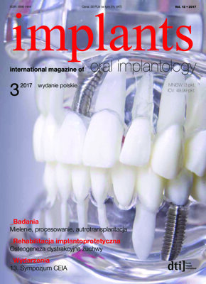implants Poland No. 3, 2017 implants Poland No. 3, 2017