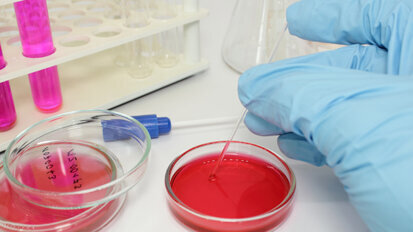 Forscher finden Ursache für Biofilm-Entstehung Forscher finden Ursache für Biofilm-Entstehung